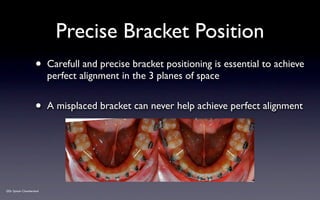 SPEED Bracket Placement Guide v2012 | KEY