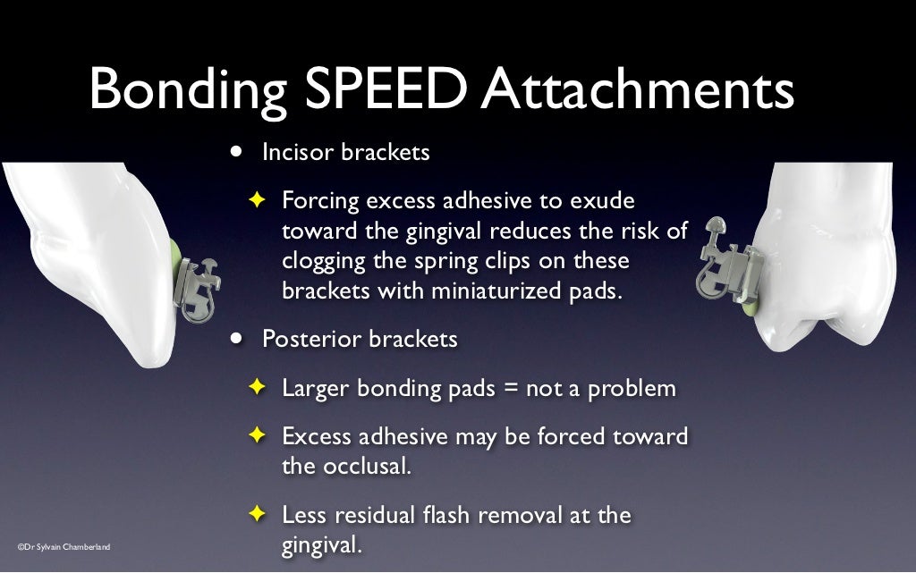 SPEED Bracket Placement Guide v2012
