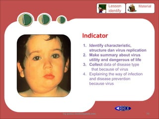 Indicator
1. Identify characteristic,
structure dan virus replication
2. Make summary about virus
utility and dangerous of life
3. Collect data of disease type
that because of virus
4. Explaining the way of infection
and disease prevention
because virus
Material
Lesson
identify
by gomes.hada@gmail.com 35
 