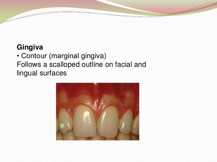 Introduction to Periodontics