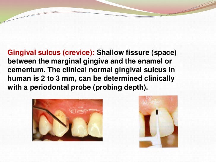 Introduction to Periodontics