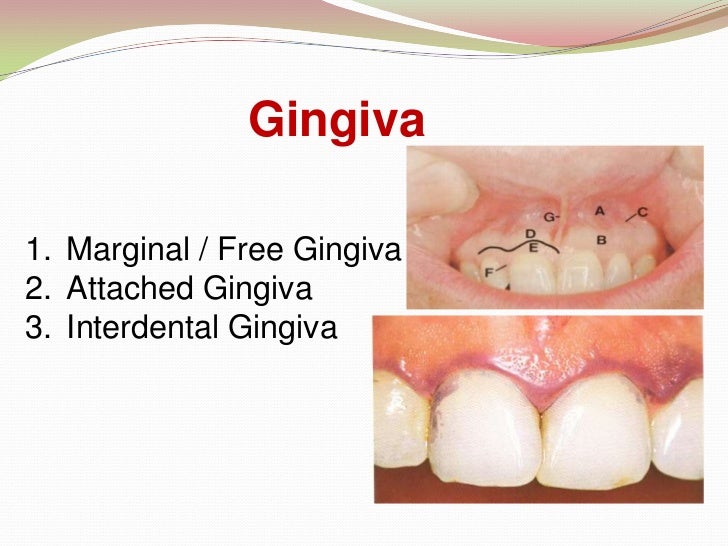 Introduction to Periodontics