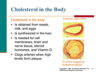 74
Cholesterol in the Body
Cholesterol in the body
 Is obtained from meats,
milk, and eggs.
 Is synthesized in the liver.
 Is needed for cell
membranes, brain and
nerve tissue, steroid
hormones, and Vitamin D.
 Clogs arteries when high
levels form plaque.
A normal, open artery.
Copyright © 2007 by Pearson Education, Inc.
Publishing as Benjamin Cummings
An artery clogged by
cholesterol plaque
 