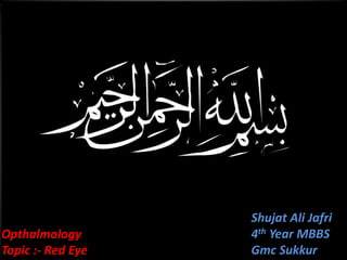 Shujat Ali Jafri
Opthalmology               4th Year MBBS
Topic :- Red Eye   Jafri
                           Gmc Sukkur
 
