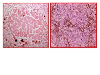 Compare histopathology