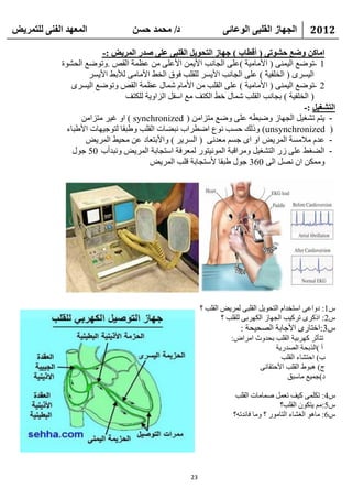 ‫انًعهذ انفًُ نهتًشيط‬               ‫د/ يحًذ حسٍ‬                    ‫انجهاص انقهثً انىعائً‬          ‫2102‬

                          ‫اياكٍ وظع حشىتً ( أقطاب ) جهاص انتحىيم انقهثً عهً صذس انًشيط :-‬
             ‫1 -رٛػغ اٌ١ّٕٝ ( األِبِ١خ )ػٍٝ اٌغبٔت األ٠ّٓ األػٍٝ ِٓ ػظّخ اٌمض .ٚرٛػغ اٌؾشٛح‬
                      ‫اٌ١َوٜ ( اٌقٍف١خ ) ػٍٝ اٌغبٔت األ٠َو ٌٍمٍت فٛق اٌقؾ األِبِٝ ٌألثؾ األ٠َو‬
                ‫2 -رٛػغ اٌ١ّٕٝ ( األِبِ١خ ) ػٍٝ اٌمٍت ِٓ األِبَ شّبي ػظّخ اٌمض ٚرٛػغ اٌ١َوٜ‬
                                  ‫( اٌقٍف١خ ) ثغبٔت اٌمٍت شّبي فؾ اٌىزف ِغ اٍفً اٌياٚ٠خ ٌٍىزف‬
                                                                                          ‫انتشغيم :-‬
                   ‫- ٠زُ رشغ١ً اٌغٙبى ٚػجطٗ ػٍٝ ٚػغ ِزيآِ ( ‪ ) synchronized‬اٚ غ١و ِزيآِ‬
               ‫( ‪ٚ )unsynchronized‬مٌه ؽَت ٔٛع اػطواة ٔجؼبد اٌمٍت ٚؽجمب ٌزٛع١ٙبد األؽجبء‬
                     ‫- ػلَ ِالَِخ اٌّو٠غ اٚ اٜ عَُ ِؼلٔٝ ( اٌَو٠و ) ٚاألثزؼبك ػٓ ِؾ١ؾ اٌّو٠غ‬
                 ‫- اٌؼغؾ ػٍٝ ىه اٌزشغ١ً ِٚوالجخ اٌّٛٔ١زٛه ٌّؼوفخ اٍزغبثخ اٌّو٠غ ٚٔجلأة 05 عٛي‬
                                          ‫ِّٚىٓ اْ ٔظً اٌٝ 063 عٛي ؽجمب ألٍزغبثخ لٍت اٌّو٠غ‬




                                                           ‫ً1: كٚاػٝ اٍزقلاَ اٌزؾٛ٠ً اٌمٍجٝ ٌّو٠غ اٌمٍت ؟‬
                                                                   ‫ً2: امووٜ روو١ت اٌغٙبى اٌىٙوثٝ ٌٍمٍت ؟‬
                                                                        ‫ً3:افزبهٜ األعبثخ اٌظؾ١ؾخ :‬
                                                                     ‫رزأصو وٙوث١خ اٌمٍت ثؾلٚس اِواع:‬
                                                                                   ‫أ )اٌنثؾخ اٌظله٠خ‬
                                                                                     ‫ة) اؽزشبء اٌمٍت‬
                                                                             ‫ط) ٘جٛؽ اٌمٍت األؽزمبٔٝ‬
                                                                                       ‫ك)عّ١غ ِبٍجك‬

                                                                       ‫ً4: رىٍّٝ و١ف رؼًّ طّبِبد اٌمٍت‬
                                                                                       ‫ً5:ُِ ٠زىْٛ اٌمٍت؟‬
                                                                      ‫ً6: ِب٘ٛ اٌغشبء اٌزبِٛه ؟ ِٚب فبئلرٗ؟‬




                                                      ‫32‬
 