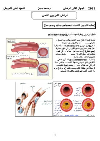 ‫انًعهذ انفًُ نهتًشيط‬   ‫د/ يحًذ حسٍ‬                 ‫انجهاص انقهثً انىعائً‬                ‫2102‬

                          ‫أمراض الشرايين التاجي‬

                            ‫(تصلب الشرايين التاجية)(‪)Coronary atherosclerosis‬‬


                                ‫باثوفيسيولوجى (كيفية حدوث المرض)(‪)Pathophysiology‬‬

                                        ‫تحدث نتيجة ارتفاع نسبة الدهون بالدم عن المستوى‬
                                               ‫< تراكم وترسيب حبيبات‬               ‫الطبيعى ــــــــ‬
                                     ‫الدهون(كوليستيرول ‪)Cholesterol‬واألنسجة التليفية‬
                                        ‫داخل جدار الشرايين التاجية فيؤدى الى تكون الخثرة‬
                                        ‫(تجمع دهنى) )‪ (Atheroma‬مما يؤدى الى تكون‬
                                       ‫<ضيق مساحة‬          ‫جلطات الدم داخل الشريان ـــــــــ‬
                                                                  ‫الشريان التاجى وتلف جداره‬
                                          ‫فيتصلب( ‪ )Atherosclerosis‬ويفقد قابليته على‬
                                      ‫األنقباض لدفع الدم الى انسجة القلب ــــــ <نقص كمية‬
                                        ‫<نقص كمية األكسجين‬            ‫الدم التى تمر خالله ـــــــ‬
                                     ‫الواصلة الى عضلة القلب ـــــــــ< تلف (أو موت ) جزء‬
                                              ‫من عضلة القلب التى تتغذى بالشريان المصاب‬




                                      ‫5‬
 