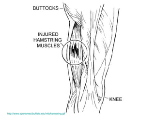 http://www.sportsmed.buffalo.edu/info/hamstring.gif   
