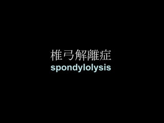椎弓解離症 spondylolysis 