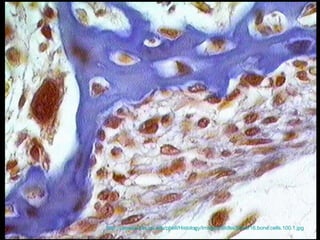 http://casweb.cas.ou.edu/pbell/Histology/Images/Slides/Bone/16.bone.cells.100.1.jpg   