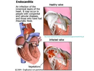 http://www.heartcenteronline.com/myheartdr/images/article/ACFA2.gif   