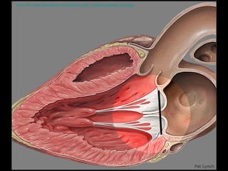 http://info.med.yale.edu/intmed/cardio/chd/e_marfan/prolapse_both.jpg   