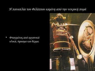 Η πανοπλία του Φιλίππου καμένη από την νεκρική πυρά




• Φτιαγμένος από οργανικά
  υλικά, ύφασμα και δέρμα.
 