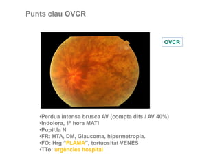OVCR
Punts clau OVCR
•Perdua intensa brusca AV (compta dits / AV 40%)
•Indolora, 1º hora MATI
•Pupil.la N
•FR: HTA, DM, Glaucoma, hipermetropia.
•FO: Hrg “FLAMA”, tortuositat VENES
•TTo: urgències hospital
 