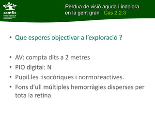 • Que esperes objectivar a l’exploració ?
• AV: compta dits a 2 metres
• PIO digital: N
• Pupil.les :isocòriques i normoreactives.
• Fons d’ull múltiples hemorràgies disperses per
tota la retina
Pèrdua de visió aguda i indolora
en la gent gran Cas 2.2.3
 