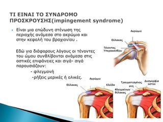  Δίλαη κηα επψδπλε ζηέλσζε ηεο
πεξηνρήο αλάκεζα ζην αθξψκην θαη
ζηελ θεθαιή ηνπ βξαρηνλίνπ .
Δδψ γηα δηάθνξνπο ιφγνπο νη ηέλνληεο
ηνπ ψκνπ ζπλζιίβνληαη αλάκεζα ζηηο
νζηηθέο επηθάλεηεο θαη ζηγά- ζηγά
παξνπζηάδνπλ:
- θιεγκνλή
-ξήμεηο κεξηθέο ή νιηθέο.
Ακρώμιο
Θύλακας
Τένοντας
Υπερακανθίου
Κλείδα
Ακρώμιο
Θύλακας
Φλεγμαίνων
θύλακας
Τραυματισμένος
μυς
Δυσμορφία
οστού
 