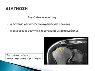 Ππρλά είλαη απαξαίηεηε:
 ε εθηέιεζε καγλεηηθήο ηνκνγξαθίαο ζηελ πεξηνρή
 ν ζπλδπαζκφο καγλεηηθή ηνκνγξαθίαο κε αξζξνγξάθεκα
Ρν ηελφληην πέηαιν
ζηελ καγλεηηθή ηνκνγξαθία
 
