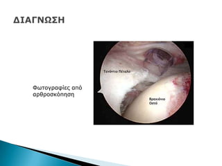 Φσηνγξαθίεο απφ
αξζξνζθφπεζε
 