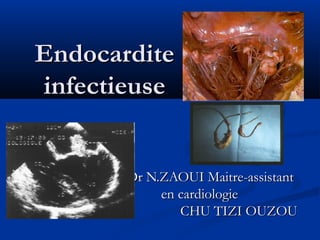 Endocardite
infectieuse

Dr N.ZAOUI Maitre-assistant
en cardiologie
CHU TIZI OUZOU

 