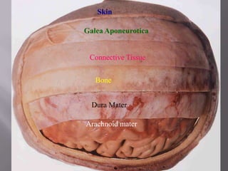 Skin
Galea Aponeurotica

Connective Tissue
Bone
Dura Mater
Arachnoid mater

 
