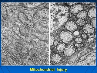 Mitochondrial Injury

 