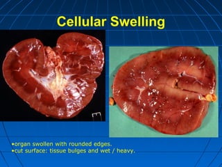 Cellular Swelling

•organ swollen with rounded edges.
•cut surface: tissue bulges and wet / heavy.

 