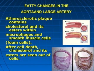 FATTY CHANGES IN THE
AORTAAND LARGE ARTERY
Atherosclerotic plaque
contains
cholesterol and its
esters within
macrophages and
smooth muscle cells
(foam cells).
After cell death,
cholesterol and its
esters are seen out of
cells.

 