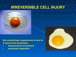 IRREVERSIBLE CELL INJURY

the morphologic appearance is due to
2 concurrent processes:
1.
denaturation of proteins
2.
enzymatic digestion

 