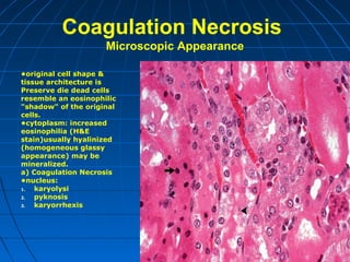 Coagulation Necrosis
Microscopic Appearance
•original cell shape &
tissue architecture is
Preserve die dead cells
resemble an eosinophilic
"shadow" of the original
cells.
•cytoplasm: increased
eosinophilia (H&E
stain)usually hyalinized
(homogeneous glassy
appearance) may be
mineralized.
a) Coagulation Necrosis
•nucleus:
1.
karyolysi
2.
pyknosis
3.
karyorrhexis

 