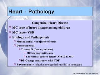 Heart - Pathology
Congenital Heart Disease
 MC type of heart disease among children
 MC type= VSD
 Etiology and Pathogenesis
 Multifactorial = majority of cases
 Developmental
 Trisomy 21 (Down syndrome)
 MC known genetic cause
 Endocardial cushion defects (AVSD) & ASD

Di -George syndrome with TOF
 Environment= infection (congenital rubella) or teratogens
1
Dr. Krishna Tadepalli, MD, www.mletips.com

 
