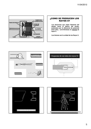 11/04/2013

FUENTE DE
ALIMENTACIÓN

¿COMO SE PRODUCEN LOS
RAYOS X?

TUBO DE RAYOS X
FILTRO DE
ALUMINIO

CILINDRO

COLIMADOR

Los electrones que viajan filamento del
cátodo hacia el blanco del ánodo,
acelerados por la diferencia de potencial
entre ellos, convirtiéndose en fotones de
rayos X.
Los fotones son la unidad de los Rayos X.

ACEITE
REFRIGERANTE

YUGO

NUBE DE
ELECTRONES

Esquema de un tubo de rayos X

DISPARO

BLANCO

PROYECCIÓN DE ELECTRONES

BLANCO

PROYECCIÓN DE ELECTRONES

BLANCO

FORMACIÓN DE RAYOS X
FORMACIÓN DE RAYOS X CON LOGITUD DE ONDA VARIADA

5

 