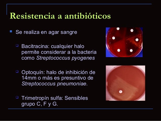 2.1 estreptococcos y enterococcus