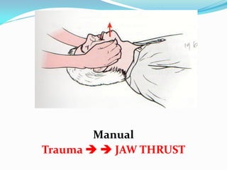 2. airway and breathing management 11 | PDF