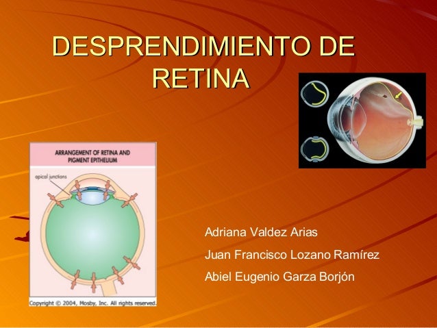 2.8 desprendimiento de retina 2.8 desprendimiento de retina