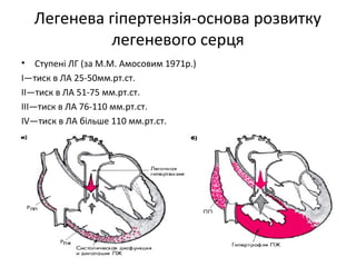 легенева гіпертензія | PPT