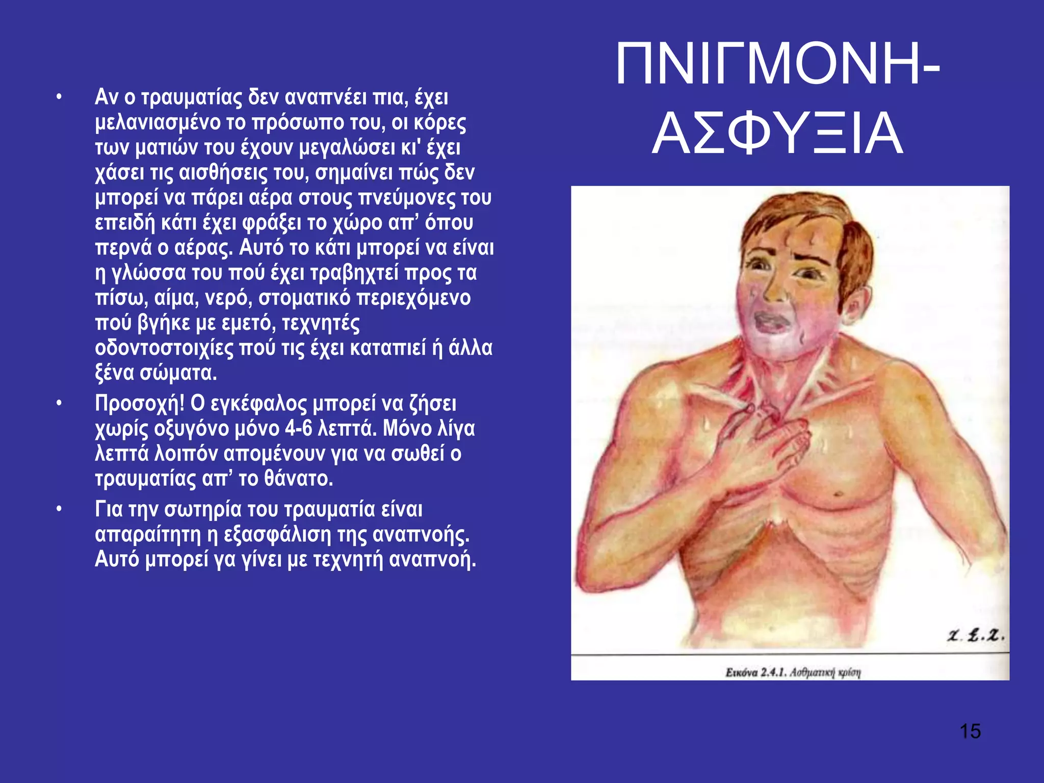 15
ΠΝΙΓΜΟΝΗ-
Α΢ΦΤΞΙΑ
• Αλ ν ηξαπκαηίαο δελ αλαπλέεη πηα, έρεη
κειαληαζκέλν ην πξόζσπν ηνπ, νη θόξεο
ησλ καηηώλ ηνπ έρνπλ κεγαιώζεη θη' έρεη
ράζεη ηηο αηζζήζεηο ηνπ, ζεκαίλεη πώο δελ
κπνξεί λα πάξεη αέξα ζηνπο πλεύκνλεο ηνπ
επεηδή θάηη έρεη θξάμεη ην ρώξν απ’ όπνπ
πεξλά ν αέξαο. Απηό ην θάηη κπνξεί λα είλαη
ε γιώζζα ηνπ πνύ έρεη ηξαβερηεί πξνο ηα
πίζσ, αίκα, λεξό, ζηνκαηηθό πεξηερόκελν
πνύ βγήθε κε εκεηό, ηερλεηέο
νδνληνζηνηρίεο πνύ ηηο έρεη θαηαπηεί ή άιια
μέλα ζώκαηα.
• Πξνζνρή! Ο εγθέθαινο κπνξεί λα δήζεη
ρσξίο νμπγόλν κόλν 4-6 ιεπηά. Μόλν ιίγα
ιεπηά ινηπόλ απνκέλνπλ γηα λα ζσζεί ν
ηξαπκαηίαο απ’ ην ζάλαην.
• Γηα ηελ ζσηεξία ηνπ ηξαπκαηία είλαη
απαξαίηεηε ε εμαζθάιηζε ηεο αλαπλνήο.
Απηό κπνξεί γα γίλεη κε ηερλεηή αλαπλνή.
 