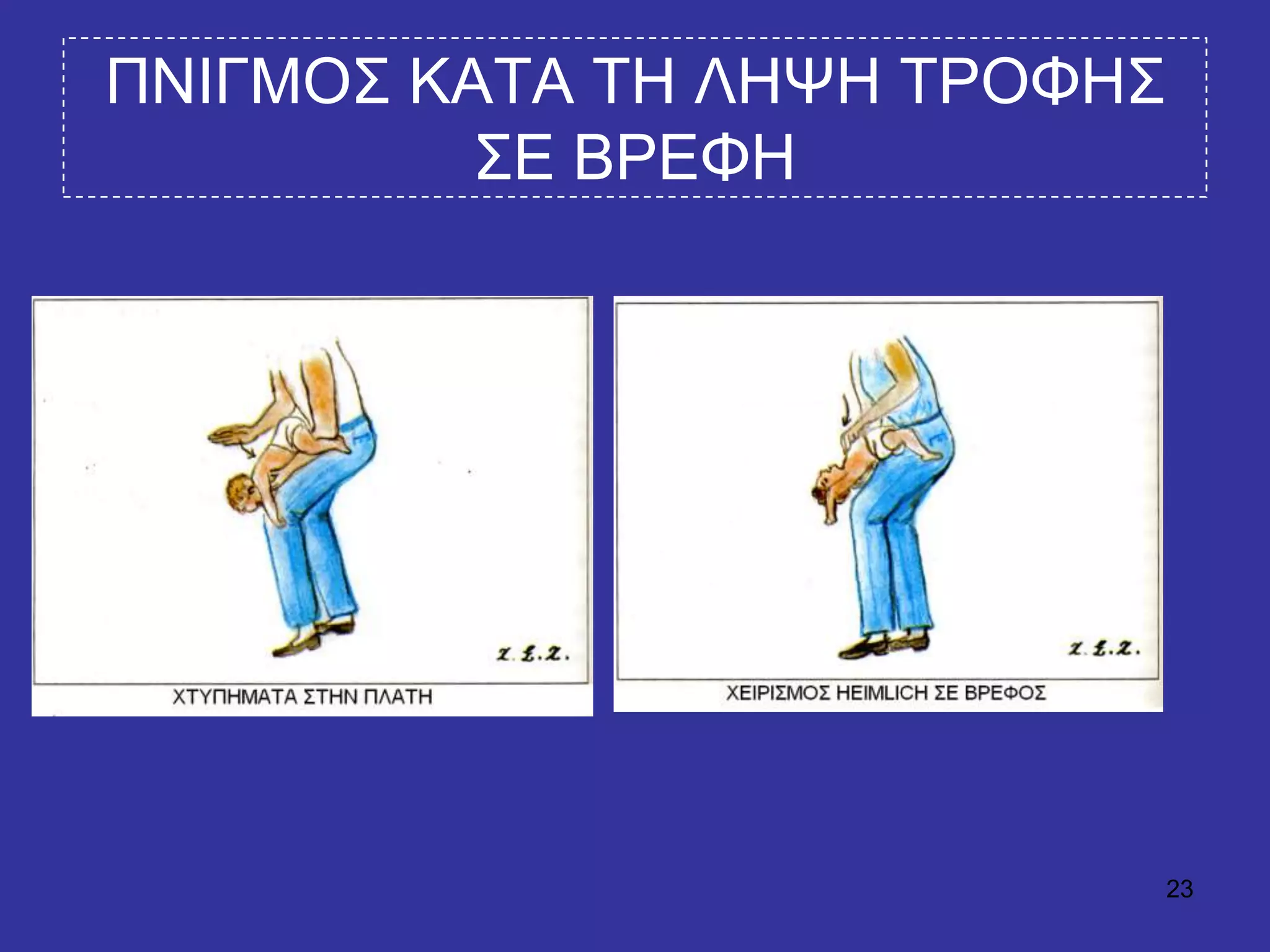 23
ΠΝΙΓΜΟ΢ ΚΑΣΑ ΣΗ ΛΗΦΗ ΣΡΟΦΗ΢
΢Δ ΒΡΔΦΗ
 