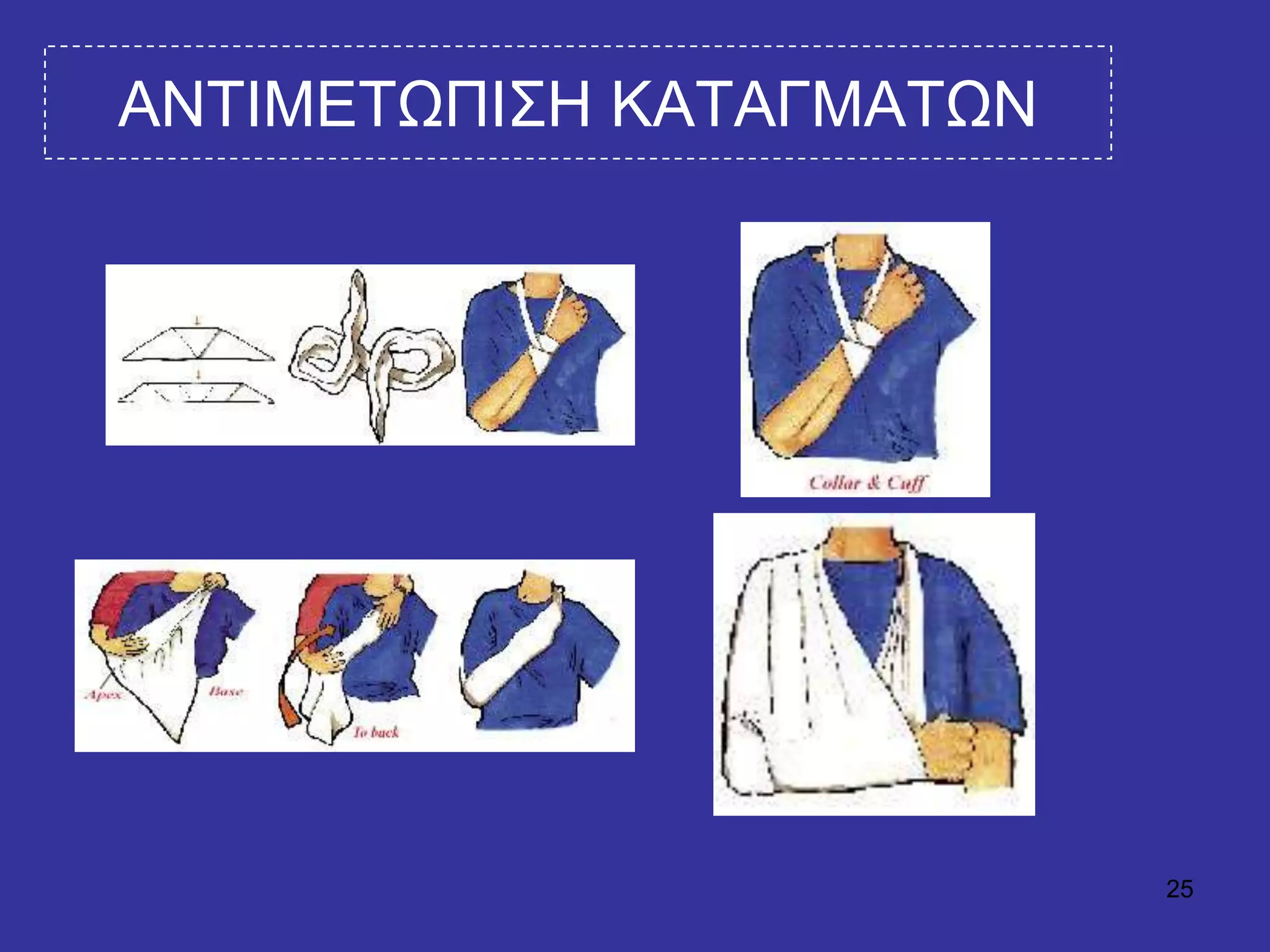 25
ΑΝΣΙΜΔΣΧΠΙ΢Η ΚΑΣΑΓΜΑΣΧΝ
 