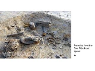 Remains from the
Gas Attacks of
Ypres

 