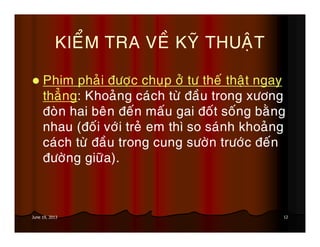 12June 19, 2013
KIEÅM TRA VEÀ KYÕ THUAÄT
Phim phaûi ñöôïc chuïp ôû tö theá thaät ngay
thaúng: Khoaûng caùch töø ñaàu trong xöông
ñoøn hai beân ñeán maáu gai ñoát soáng baèng
nhau (ñoái vôùi treû em thì so saùnh khoaûng
caùch töø ñaàu trong cung söôøn tröôùc ñeán
ñöôøng giöõa).
 