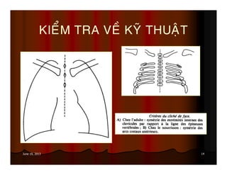 14June 19, 2013
KIEÅM TRA VEÀ KYÕ THUAÄT
 