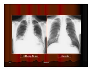 19-Jun-1320
Hít không đủ sâu Hít đủ sâu
 