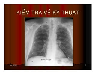 21June 19, 2013
KIEÅM TRA VEÀ KYÕ THUAÄT
 