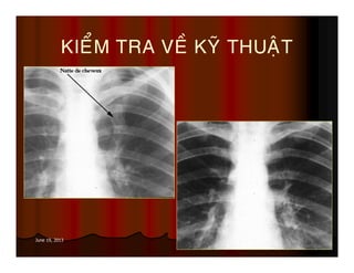 24June 19, 2013
KIEÅM TRA VEÀ KYÕ THUAÄT
 