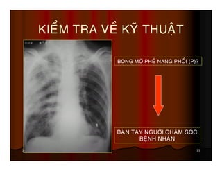 25June 19, 2013
KIEÅM TRA VEÀ KYÕ THUAÄT
BAØN TAY NGÖÔØI CHAÊM SOÙC
BEÄNH NHAÂN
BOÙNG MÔØ PHEÁ NANG PHOÅI (P)?
 