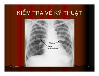 26June 19, 2013
KIEÅM TRA VEÀ KYÕ THUAÄT
 