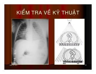 28June 19, 2013
KIEÅM TRA VEÀ KYÕ THUAÄT
 