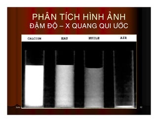 42June 19, 2013
PHAÂN TÍCH HÌNH AÛNH
ÑAÄM ÑOÄ – X QUANG QUI ÖÔÙC
 