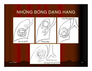 62June 19, 2013
NHÖÕNG BOÙNG DAÏNG HANG
 