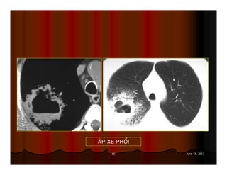 66 June 19, 2013
AÙP-XE PHOÅI
 